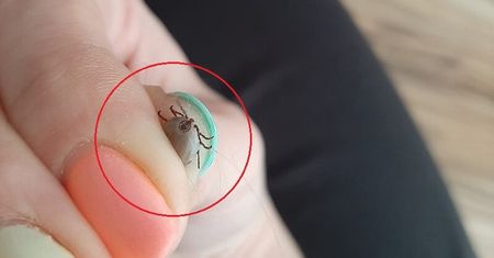 Uwaga na kleszcze, które nie śpią! Łagodna zima uaktywnia pajęczaki