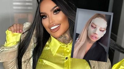 Influencerki promują 'tureckie zęby'. Zabiegi szkodliwe dla zdrowia!