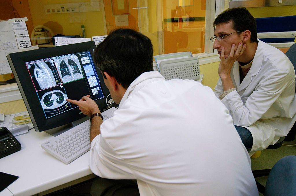 Rak płuc jest jednym z najgorzej rokujących nowotworów złośliwych - przeżycie pięcioletnie w Polsce wynosi 13,4 proc.