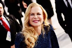 Nicole Kidman kiedyś i dziś. Botoks zrobił swoje