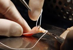 Pierwszy taki przeszczep w Polsce