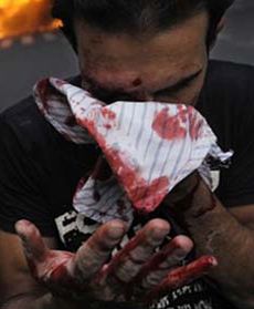 Stłumili protest gazem i kulami