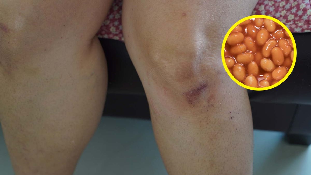 Zauważyłeś takie objawy? Organizm może wysyłać ci ważną wiadomość