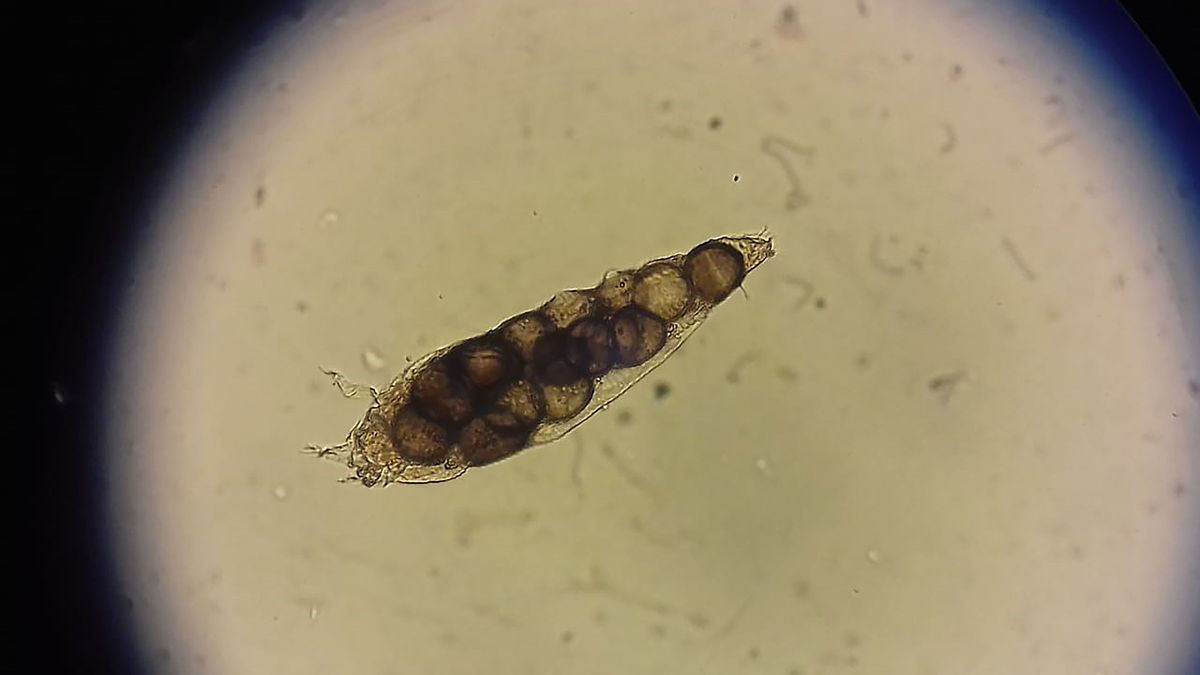 Roztocza żyją w naszych porach 