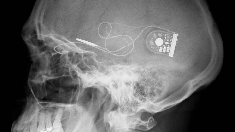 ElectRx: moc szybkiego leczenia. Będziemy zdrowieć jak superbohaterowie 1