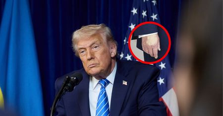 Siniaki na dłoni. Wracają pytania o zdrowie Trumpa