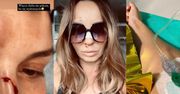 Agnieszka Włodarczyk TRAFIŁA DO SZPITALA. "Grzmotnęłam o podłogę. Obudziłam się we krwi"