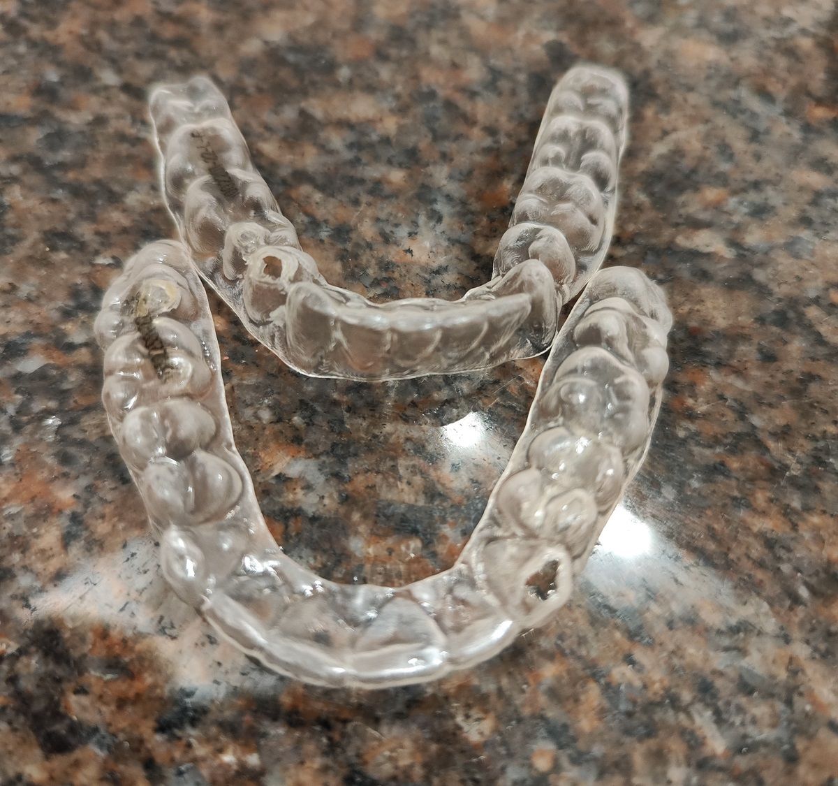 Nakładki przegryzione już po kilku dniach