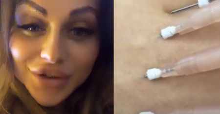 Ewelina z "Warsaw Shore" zrelacjonowała na Instagramie usuwanie cellulitu: "Nie jest to zabieg, który smyra i łaskocze"