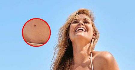 Modelka z blizną po cesarskim cięciu w znanym katalogu. "Więcej niż zwykłe zdjęcie"