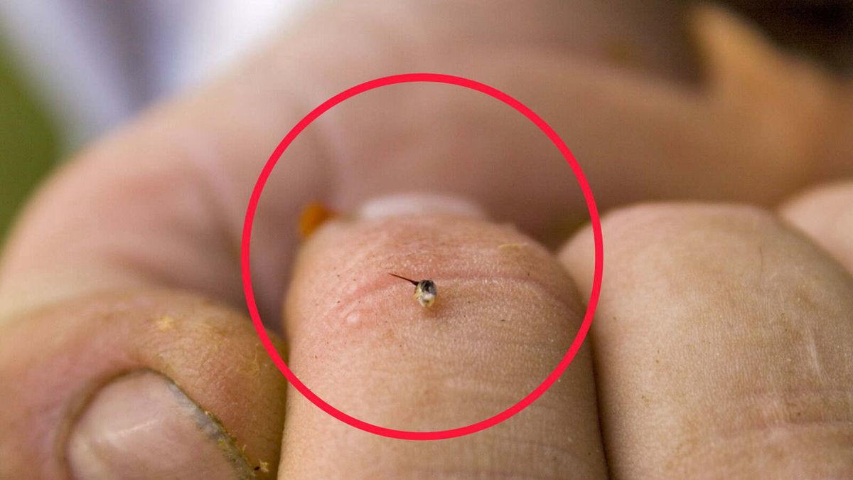 Jad pszczeli lekiem na raka? Jest nadzieja