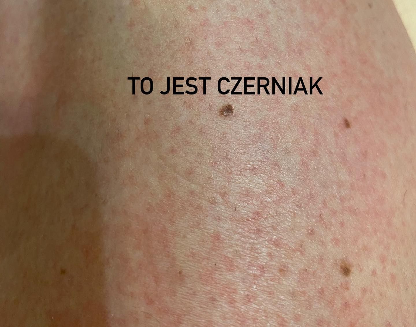 Obrazek