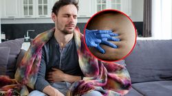 Przełom w leczeniu raka jelita grubego. "Możemy w ogóle uniknąć operacji albo jest ona mniej okaleczająca"