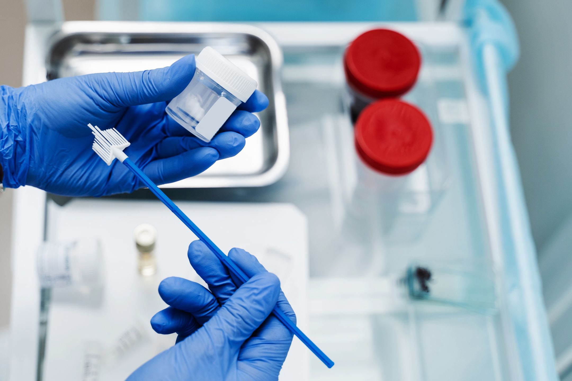 Gynecological cytology Pap smear test and cytobrush in hands of gynecologist. Gynecologist is holding flask for cytology Pap smear test in hands.
Gynecological cytology Pap smear test and cytobrush in hands of gynecologist. Gynecologist is holding flask for cytology Pap smear test in hands
pap, smear, cytology, gynecology, cytobrush, flask, gynecologist, test, pap smear, hpv, medical, patient, doctor, cervix, liquid, gynecological, medicine, health, female, hospital, cervical, woman, hpv virus, conventional, protection, woman health, equipment, prevention, disease, laboratory, cervical cancer, clinic, papanicolaou, papilloma, lab, papillomavirus, exam, cancer, nurse, biology, analysis, research, scientist, virus, tests, inspect, consultation, smears, pap, smear, cytology, gynecology, cytobrush, flask, gynecologist, test, pap smear, hpv, medical, patient, doctor, cervix, liquid, gynecological, medicine, health, female, hospital, cervical, woman, hpv virus, conventional, protection, woman health, equipment, prevention, disease, laboratory, cervical cancer, clinic, papanicolaou, papilloma, lab, papillomavirus, exam, cancer, nurse, biology, analysis, research, scientist, virus, tests, inspect, consultation, smears