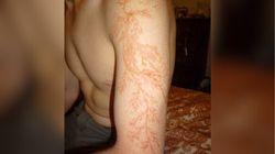 24-letni elektryk miał pecha. Lekarz pokazał zdjęcie