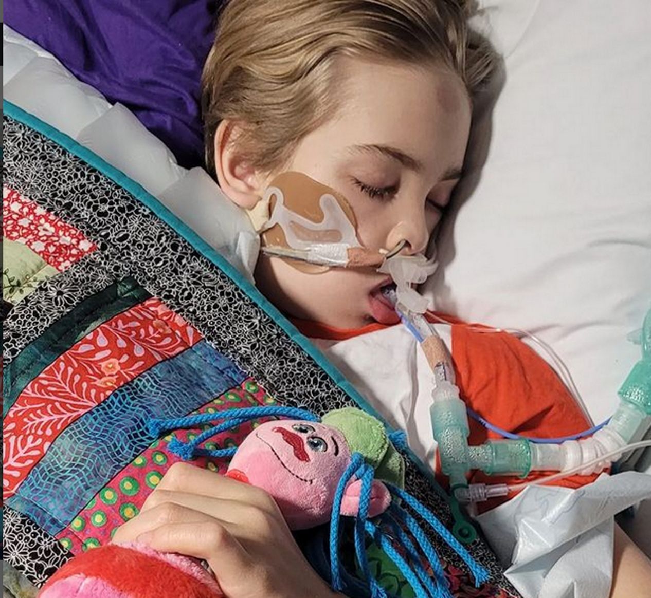 Lekarze stwierdzili śmierć pnia mózgu u 12-latka