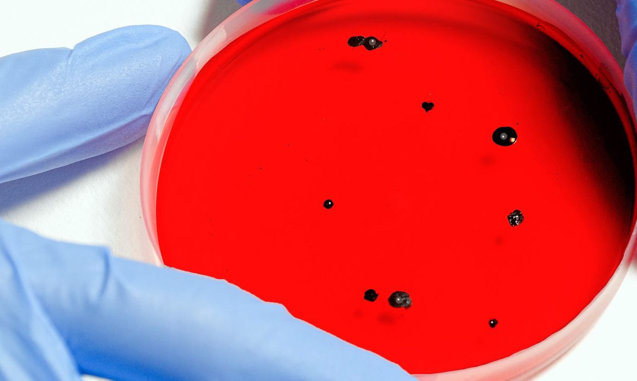 Zabójcze bakterie. Pilnie potrzebne nowe antybiotyki