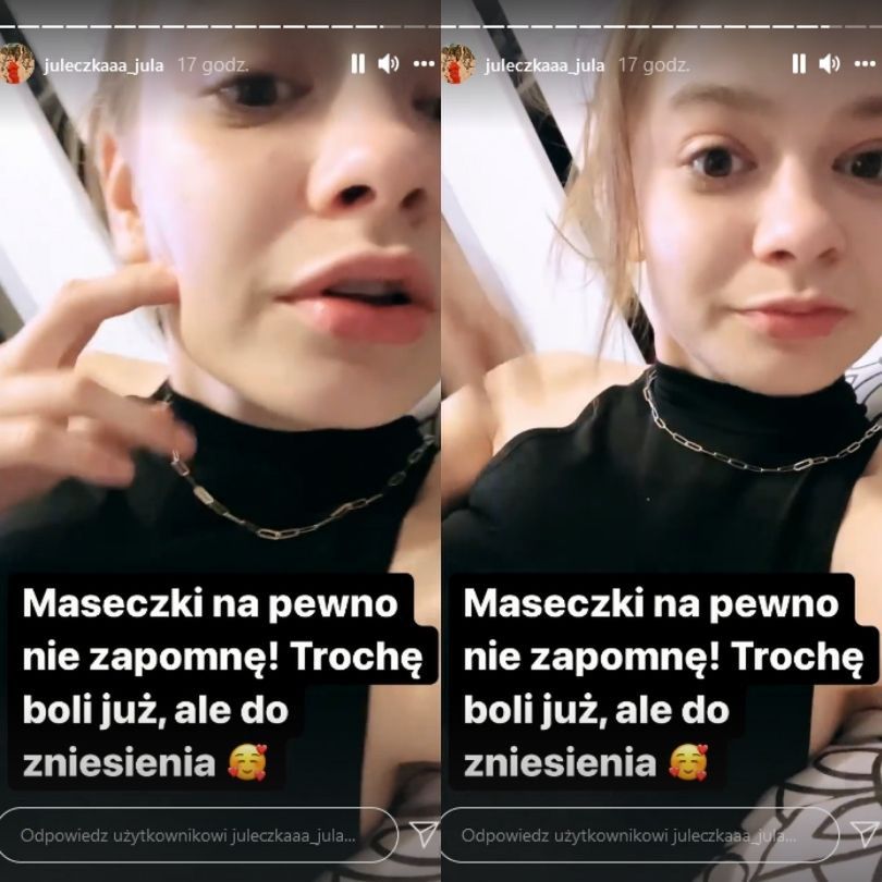 Julia Wróblewska aktualizuje stan powiększonych ust