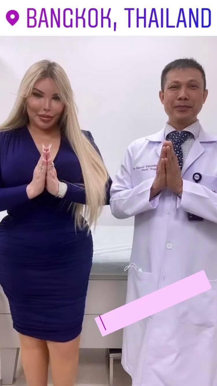 Jessica Alves przeszła operację korekty płci