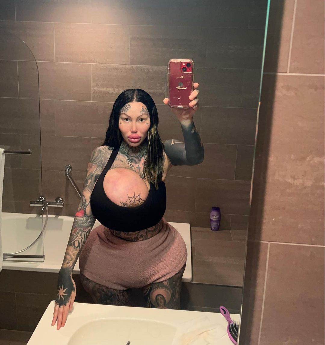 Instagramowej modelce wybuchł implant piersi. Ważył 10 kg