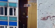 Tragiczny pożar w mieszkaniu przy ulicy Otolińskiej 23 - zginęła niepełnosprawna kobieta