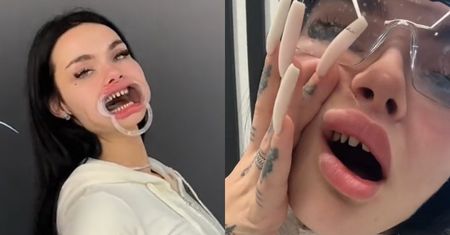 Zusje chwali się nowymi zębami, a fani krytykują: "Efekt za WIELKIEJ PROTEZY" (WIDEO)