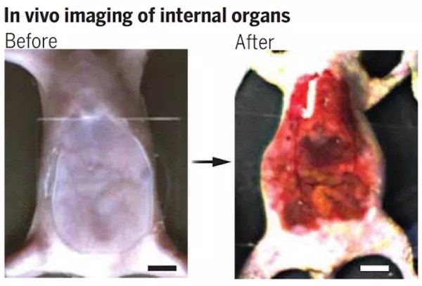Nowa technika pozwala podejrzeć organy wewnętrzne