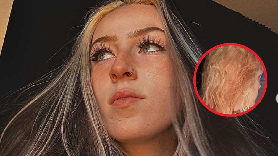 Rozjaśnianie włosów skończyło się dramatycznie