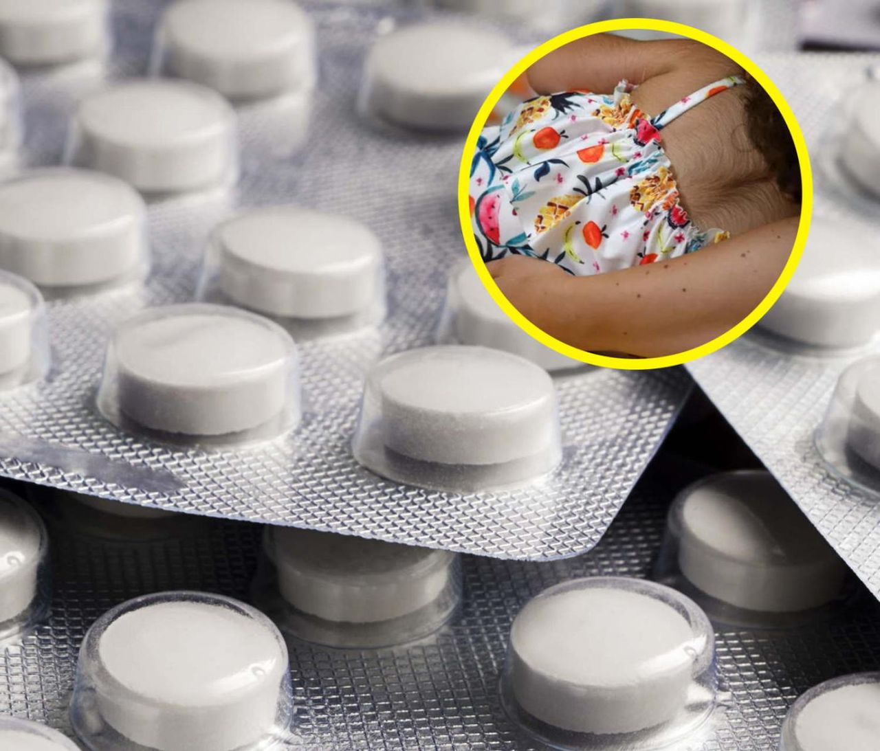 11 dzieci w Hiszpanii rozwinęło "syndrom wilkołaka". Winny okazał się lek