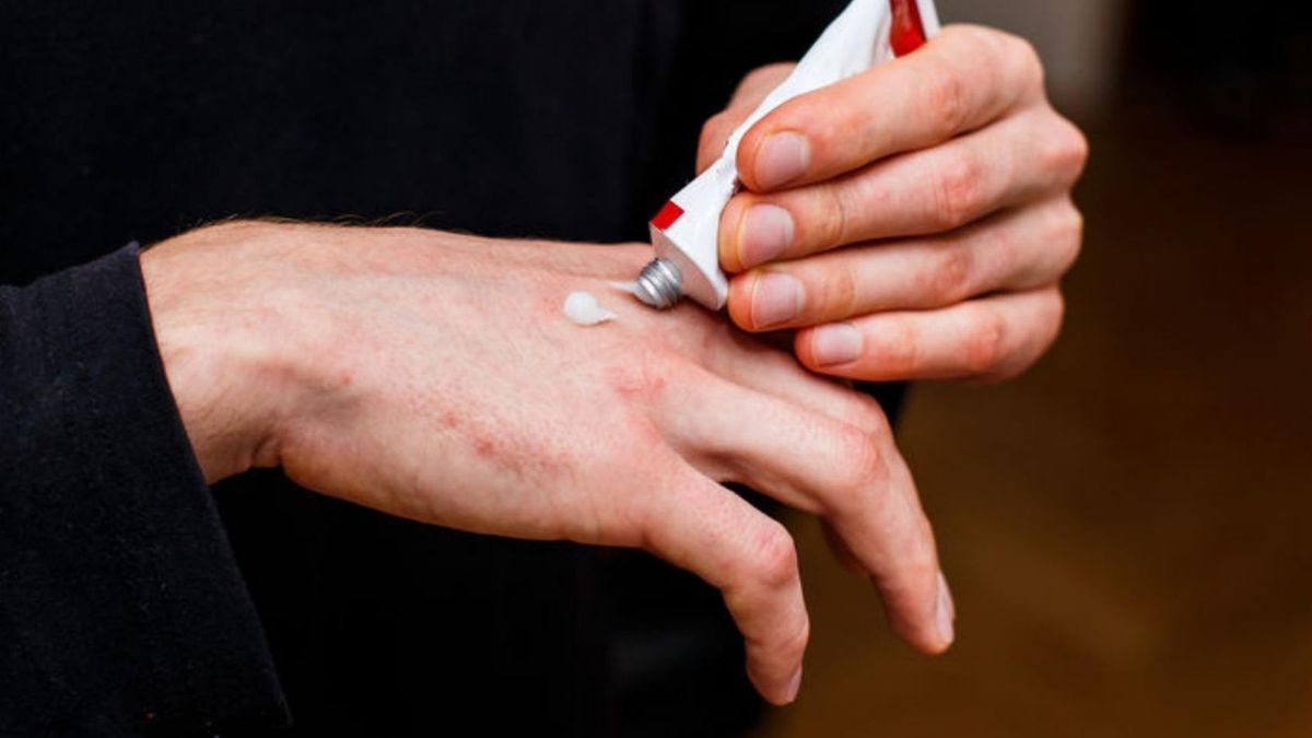 GIF: wycofanie maści Triderm