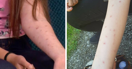 "Deodorant challenge" - nowy trend wśród nastolatków