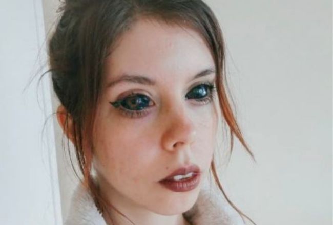 "Fanka Popka" TRACI WZROK i pozywa mężczyznę, który wytatuował jej gałki oczne