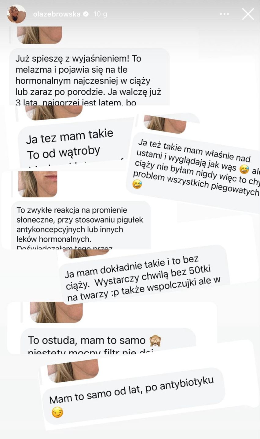 Fanki o "wąsiku" Aleksandry Żebrowskiej