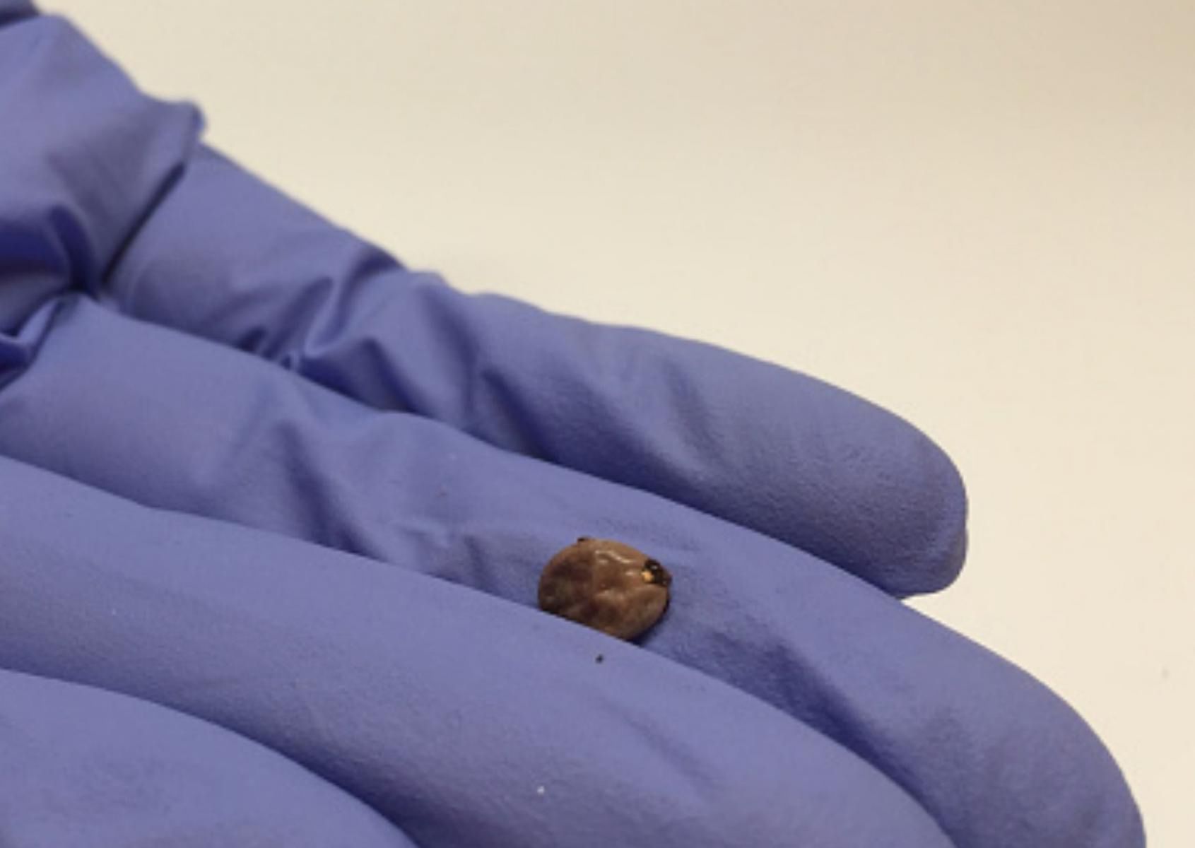 Uważaj na groźne nimfy kleszcza. Można je łatwo pomylić z pieprzykiem 