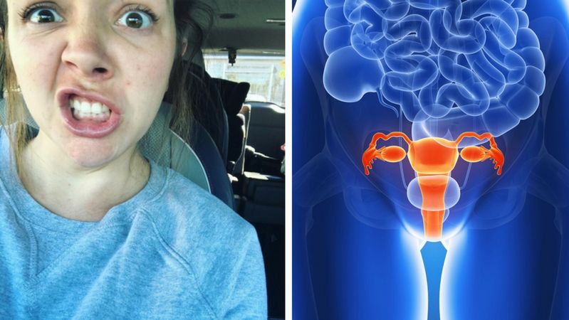 Młoda 30-letnia matka po przebyciu 4 porodów doznała schorzenia wypadania macicy