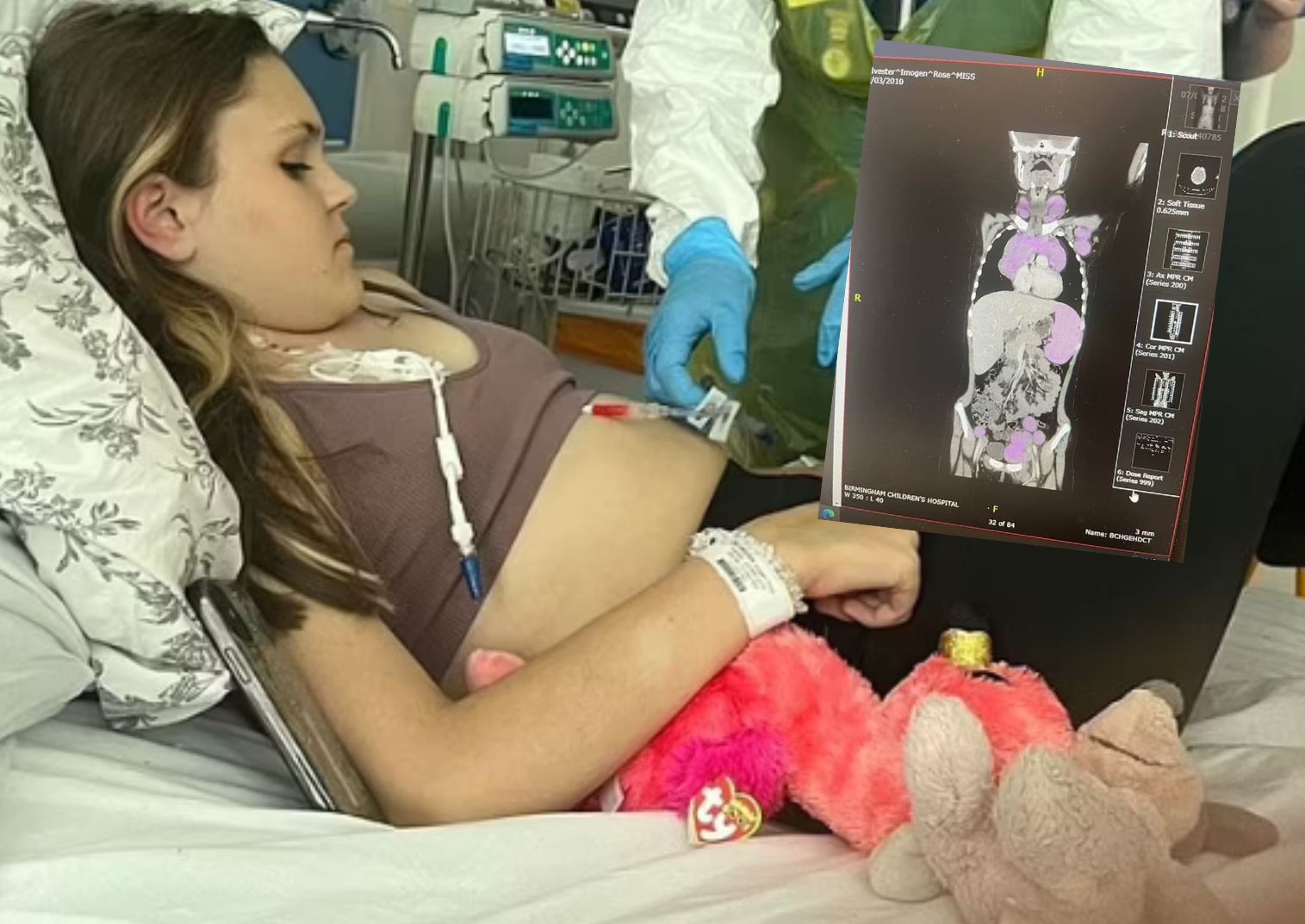 Myśleli, że to wirus. Tak maskował się chłoniak