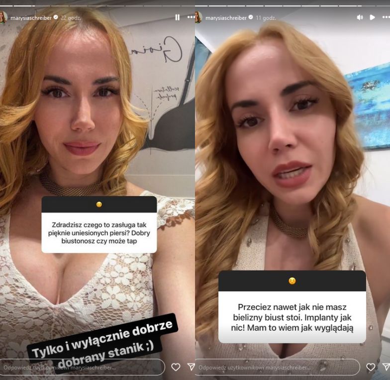 Marianna Schreiber zdradza, czy operowała biust