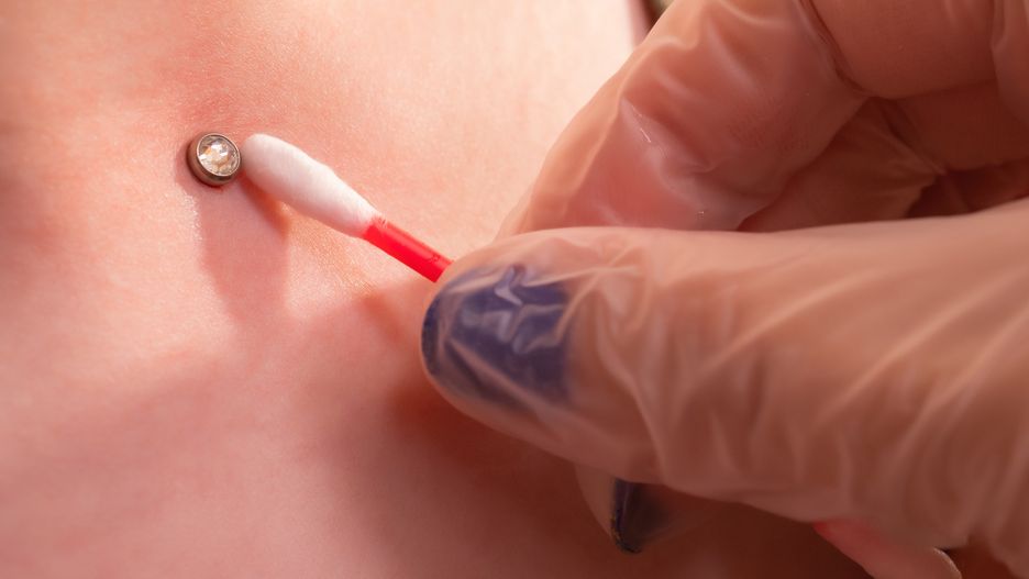 Microdermal piercing