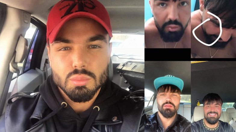 Paweł Tyburski odpowiada kosmetolog, która miała go oszpecić