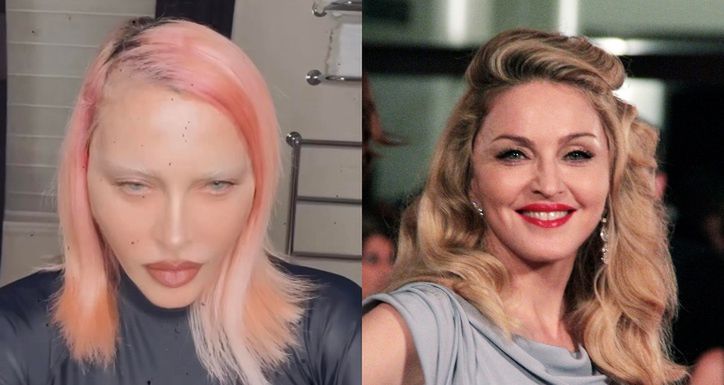 Chirurg gwiazd wymienia, jakimi zabiegami Madonna OSZPECIŁA swoją twarz w ostatnim czasie