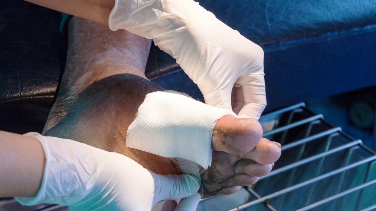 Octenilin żel skutecznie nawilża, odkaża i oczyszcza ranę