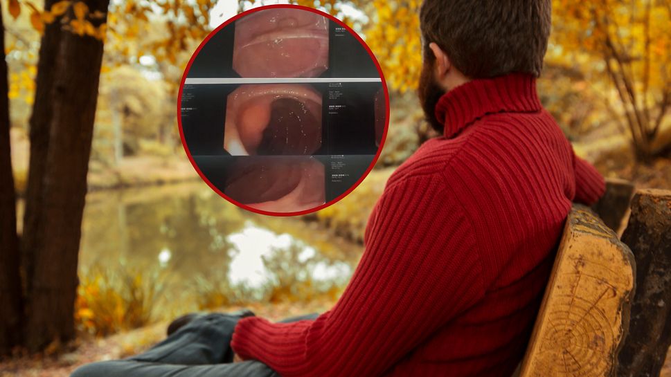 Pan Jerzy zachorował na nowotwór jelita grubego