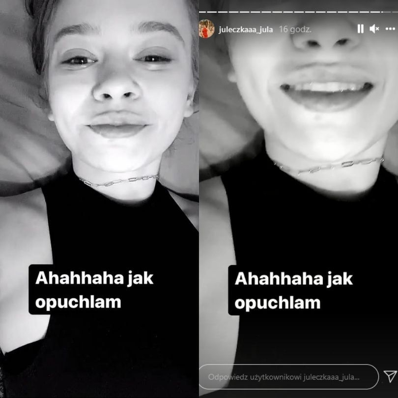 Julia Wróblewska aktualizuje stan powiększonych ust