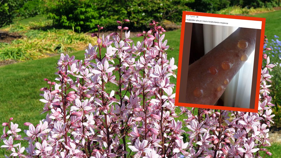 Oparzenia dyptamem mogą pozostawiać trwałe ślady