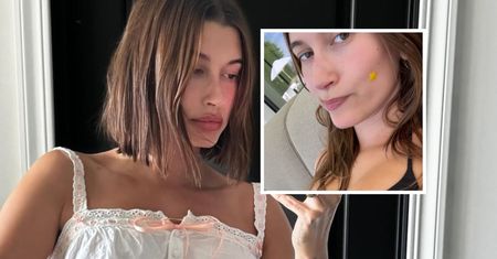 Hailey Bieber usłyszała poważną diagnozę. Zwróciła się do innych chorych kobiet