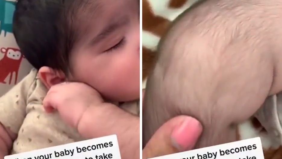 Niemowlę porośnięte gęstą szczeciną. "Kiedy twoje dziecko staje się włochate przez leki"