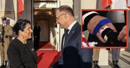 Kontuzja Dudy. Niepokojący szczegół na zdjęciach