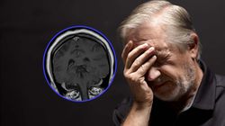 Zbadali zmarłych na COVID. Mówią o "przerażających" zmianach w mózgu