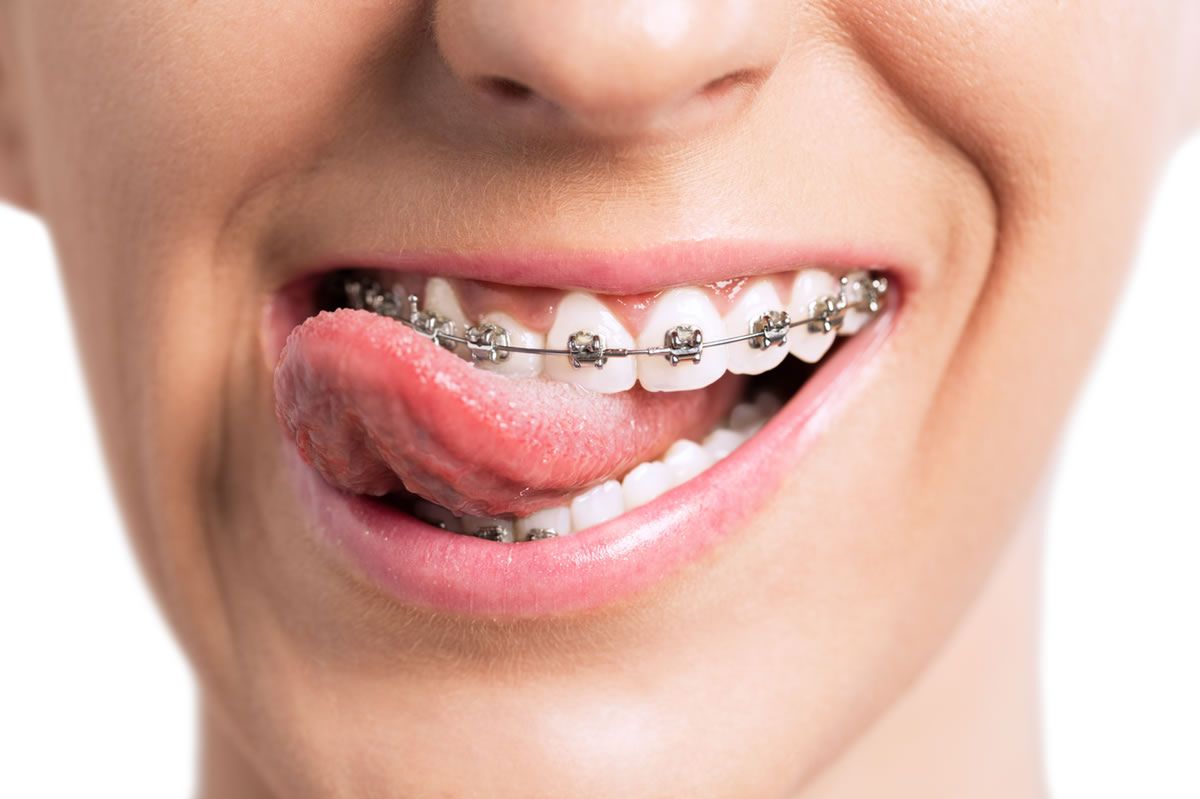 Definition of an orthodontist? How long does it take to become an orthodontist?