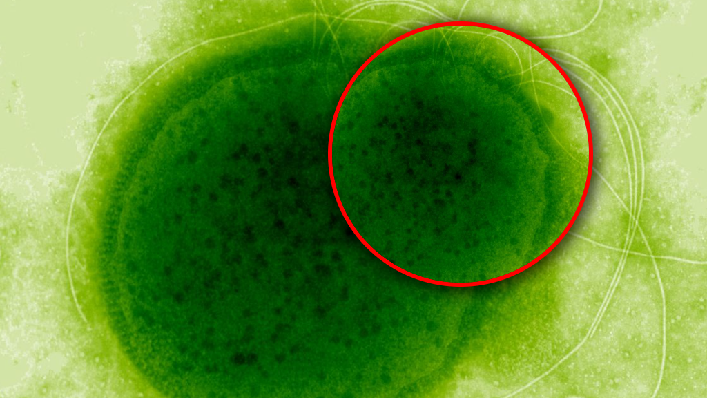 Thermococcus gammatolerans.